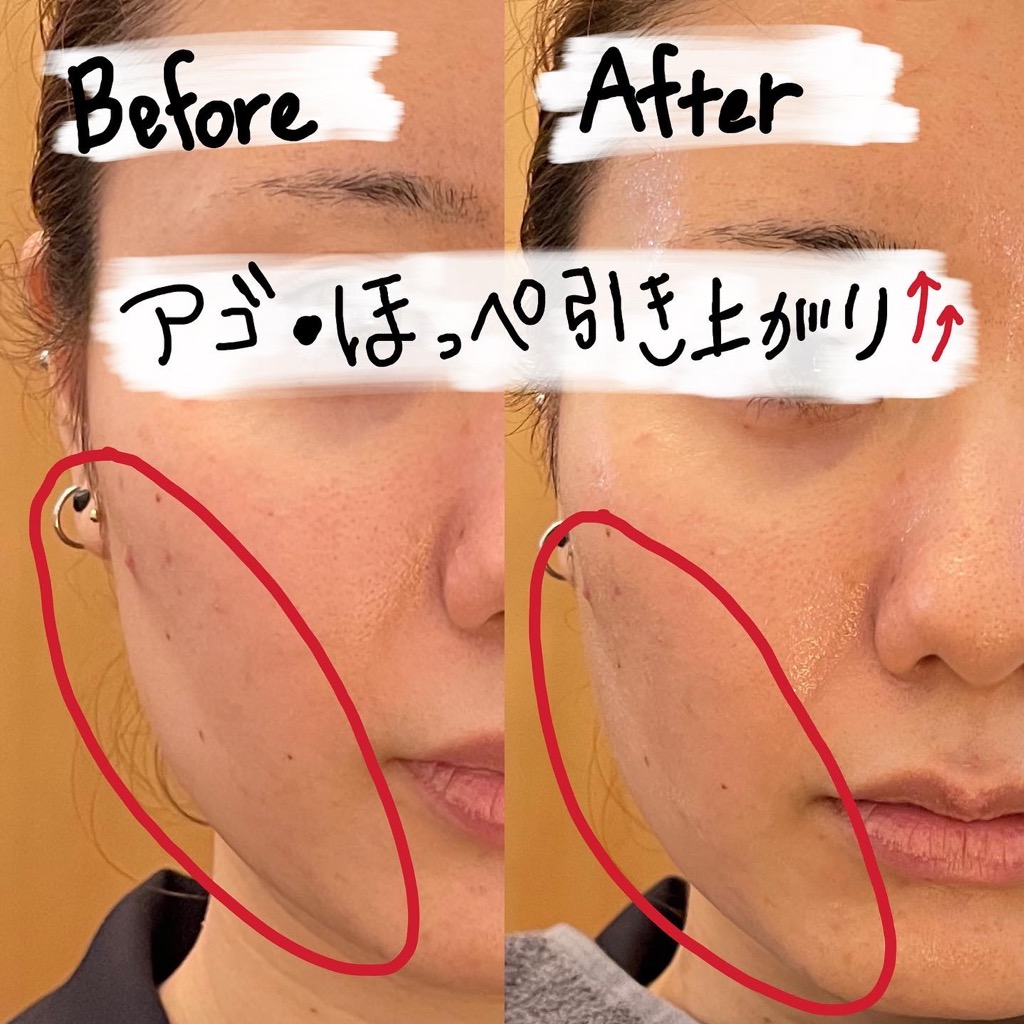陶肌のスプレーガン